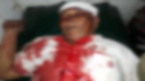 আড়াইহাজারে একই পরিবারের পাঁচজনকে কুপিয়ে জখম