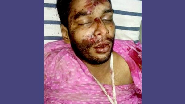 সোনারগাঁয়ে অজ্ঞাত যুবকের লাশ উদ্ধার