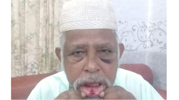 বন্দরে ভন্ড কবিরাজের কান্ড : বৃদ্ধকে মেরে আহত