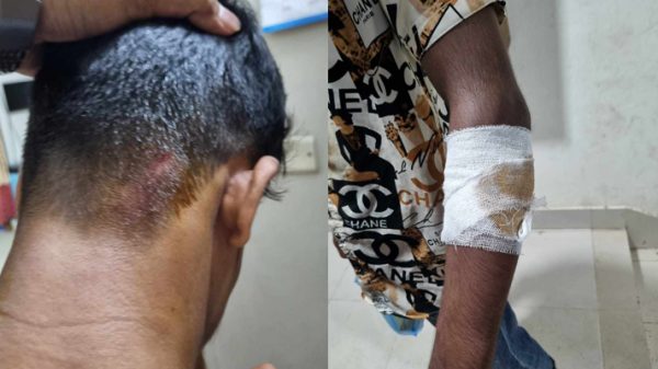 সিদ্ধিরগঞ্জে যুবককে মারধর করে মোবাইল ছিনতাই