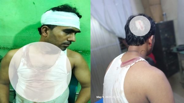 ফতুল্লায় মাদক বিক্রিতে বাধা দেওয়ায় সংঘবদ্ধ হামলা, আহত ৪