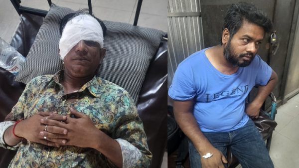 ফতুল্লায় দুই সাংবাদিকের উপর সন্ত্রাসী হামলা